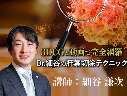 3DCGと動画で完全網羅　Dr.細谷の肝葉切除テクニック